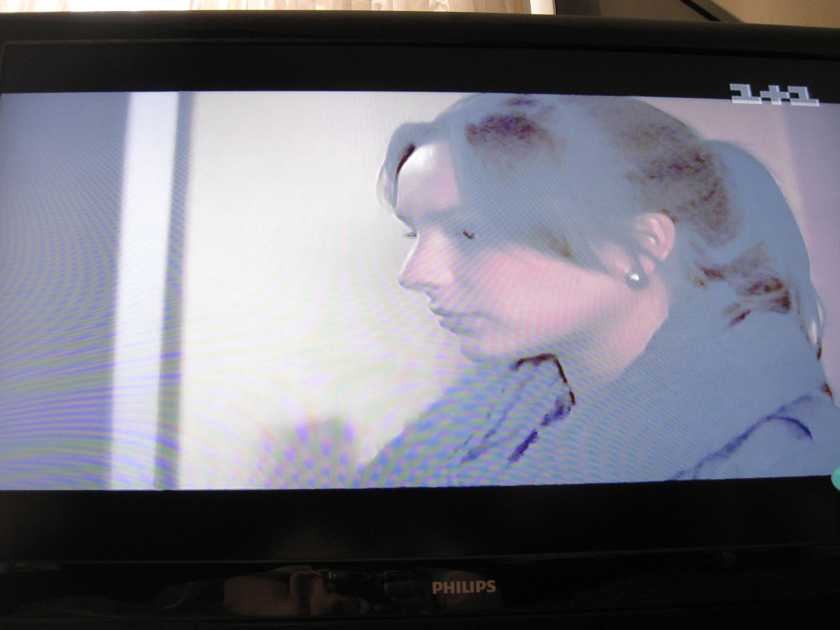 Philips 42PFL3604/12 ухудшение изображения | TV Service